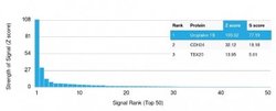 Uroplakin Ib, Mouse anti-Human, Clone: UPK1B/3081, Novus Biologicals:Antibodies:Primary